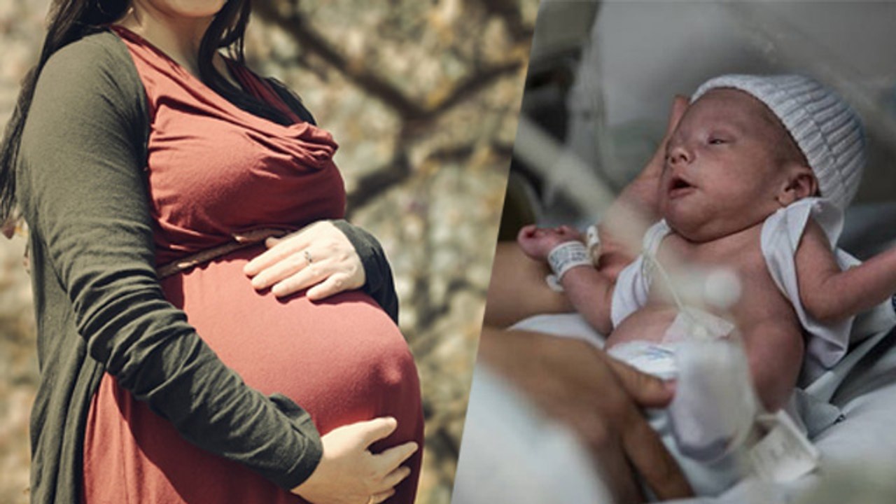 क्या मोटापा नॉर्मल डिलीवरी में परेशानी बन सकता है | Does Weight Affect Normal Delivery | Boldsky