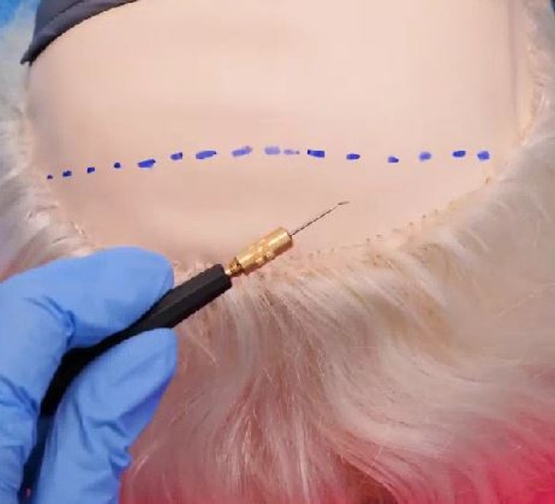 The truth about beauty! How surgery procedures are being done!