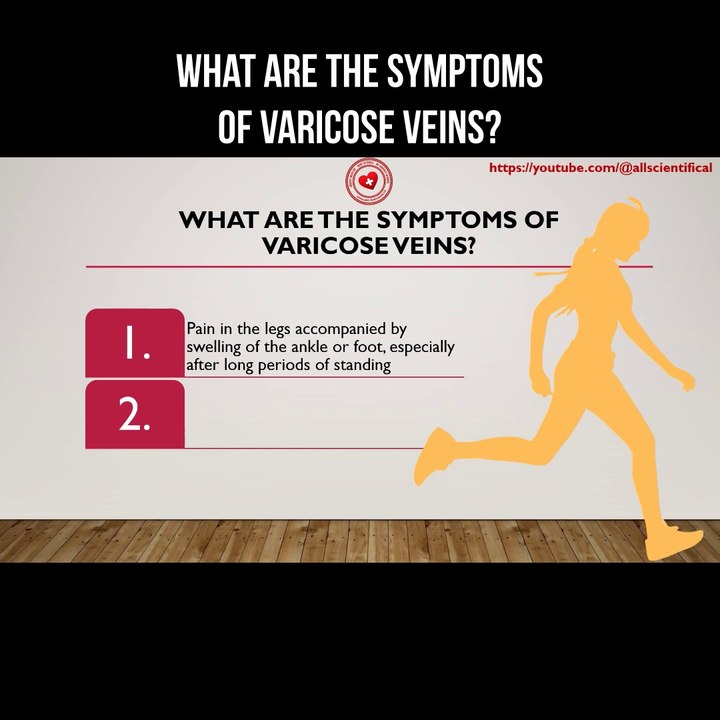 What are the symptoms of varicose veins?