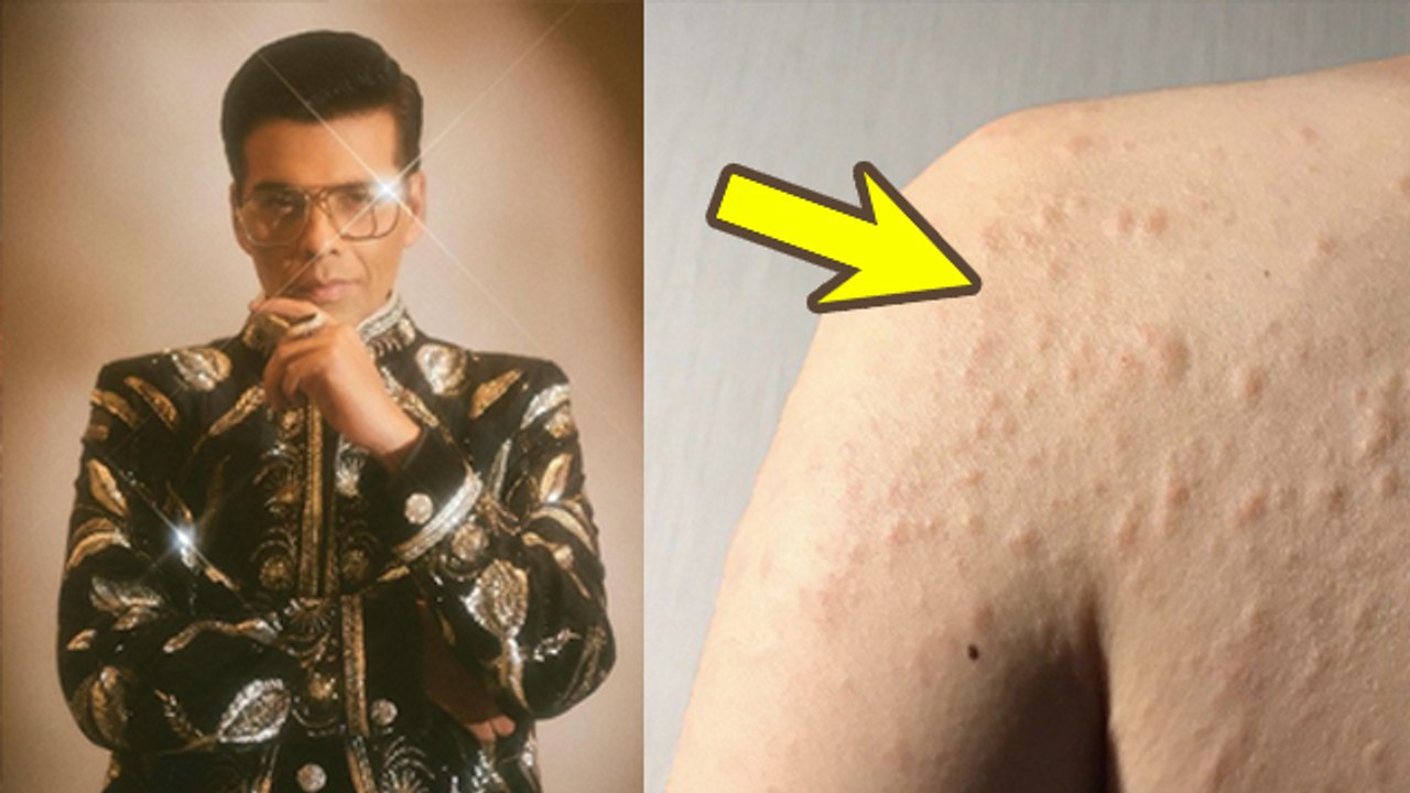 Karan Johar Suffering From Body Dysmorphic Disorder, Symptoms & Treatment...|Boldsky