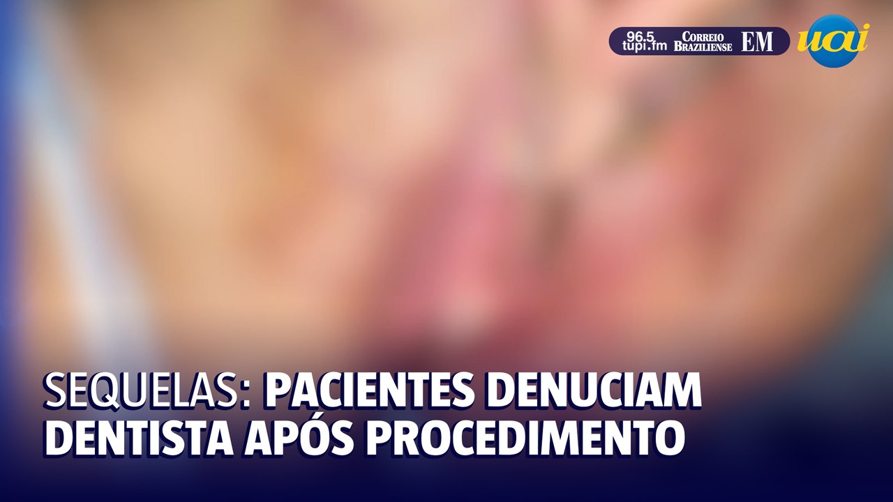 Pacientes relatam sequelas após procedimentos com dentista