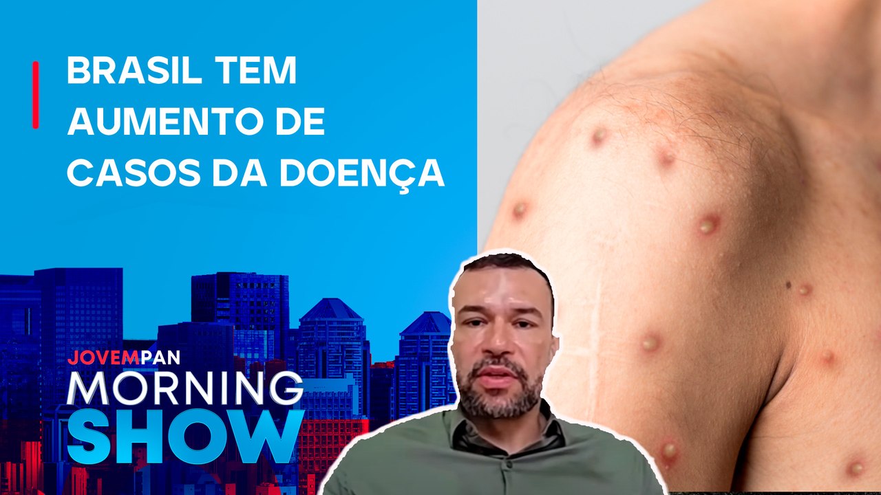 Quais são os RISCOS da Mpox? Infectologista traz DETALHES