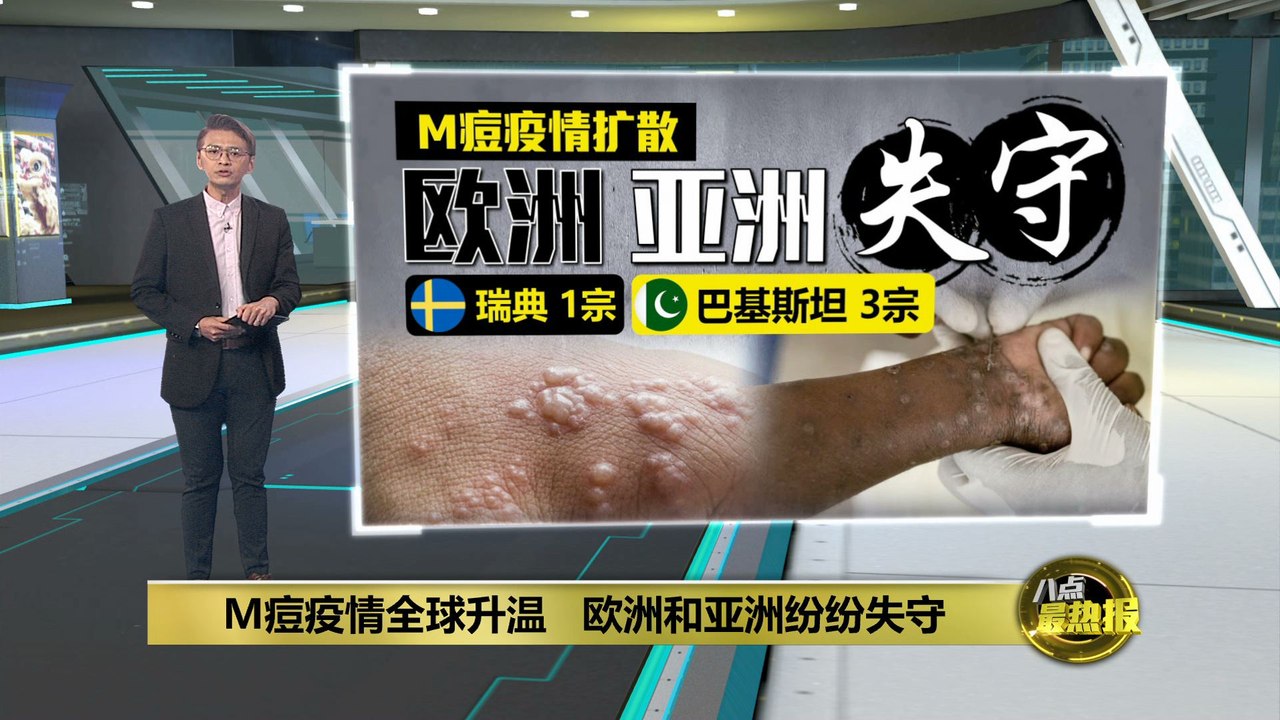 M痘疫情非洲迅速扩散   欧洲和亚洲纷纷失守