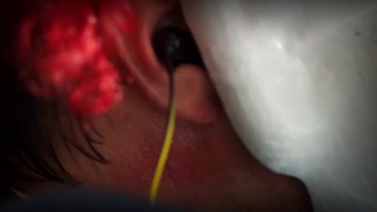 Hear me Episode 1 ( Hindi/Urdu dubbed)