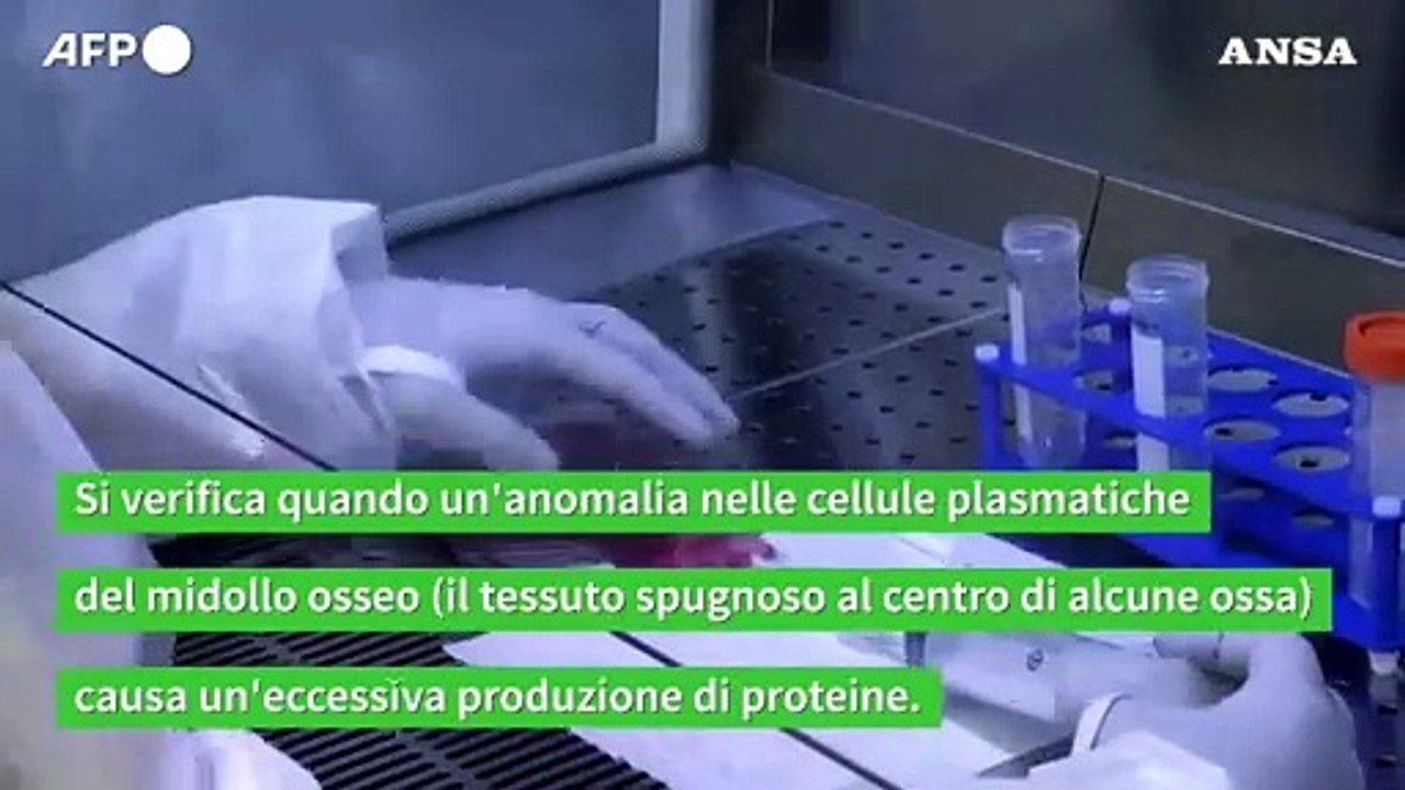 La malattia di Oliviero Toscani, che cos'e' l'amiloidosi