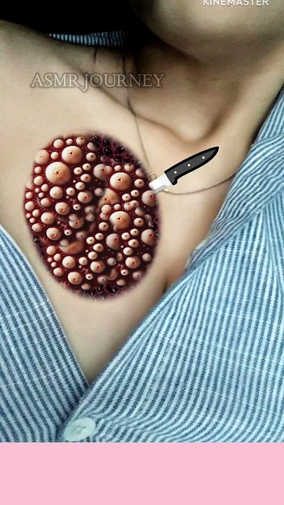 Chest cleaning treatment Animation #animation #makeup #2danimation