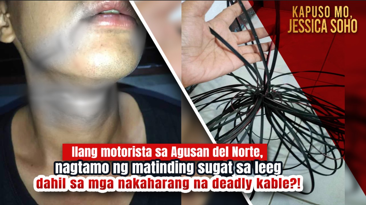 Mga motorista, sugatan ang leeg dahil sa mga nakaharang na deadly kable?! | Kapuso Mo, Jessica Soho
