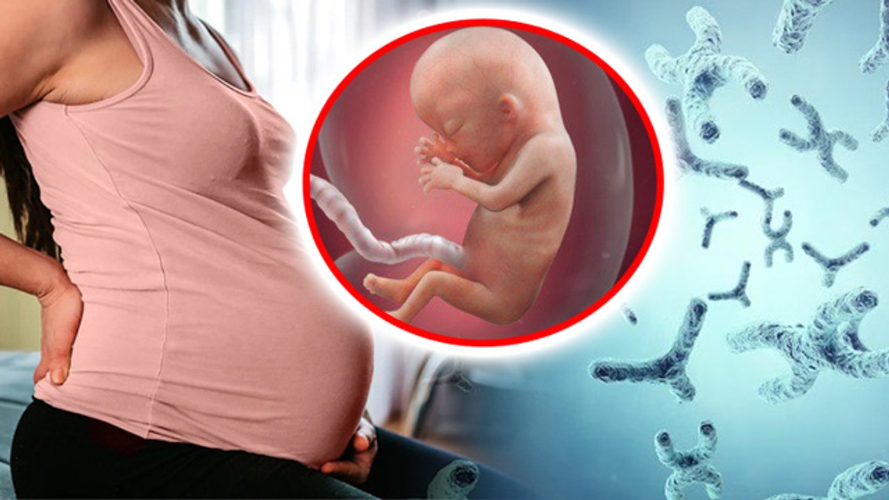 Triple X Syndrome Causes, Symptoms, Treatment & Recovery Time...