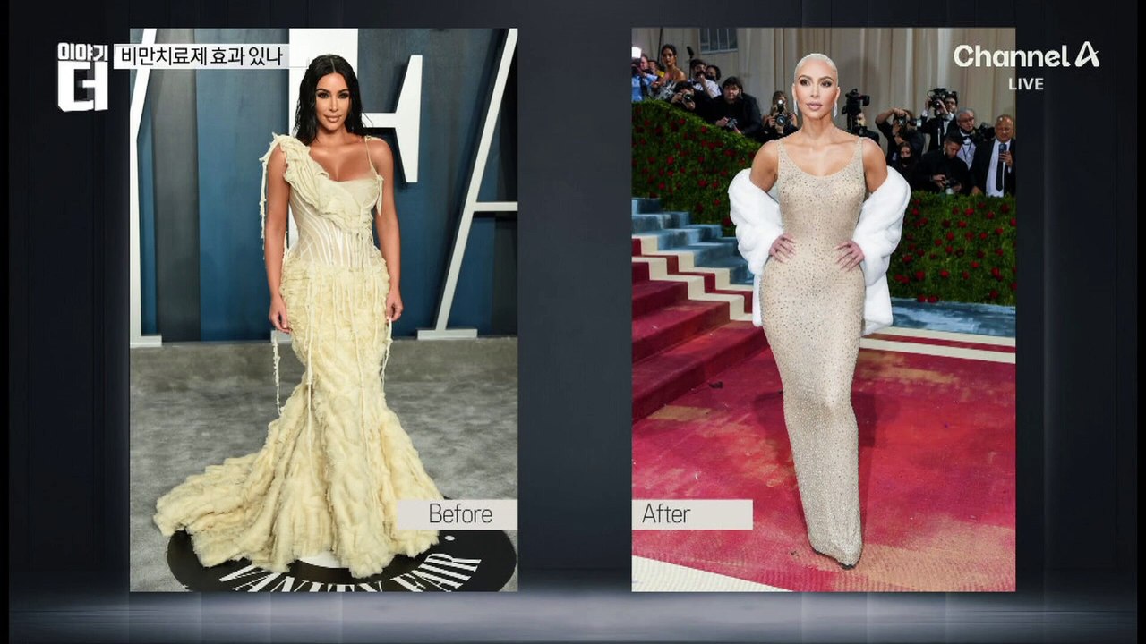 비만 치료제 상륙 임박…기생충 다이어트도 있다?