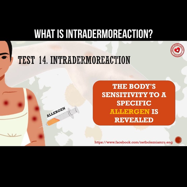 What is intradermoreaction?