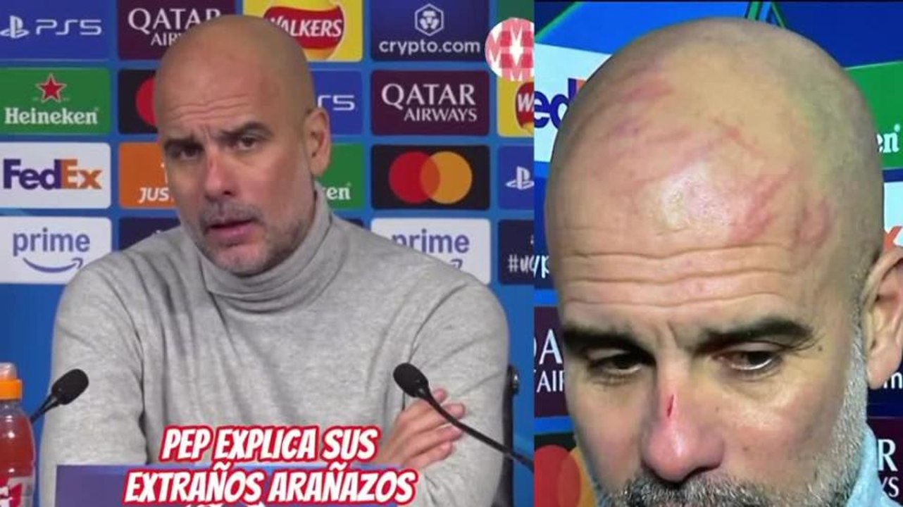 Guardiola pieno di graffi: la sua spiegazione è molto strana