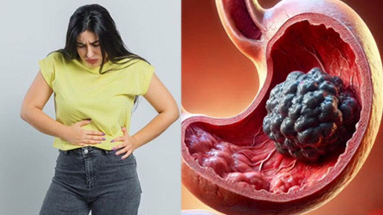 Pet Ka Gola Kaise Sahi Karte Hain | Gastric Problem In Morning Home Remedy| Boldsky