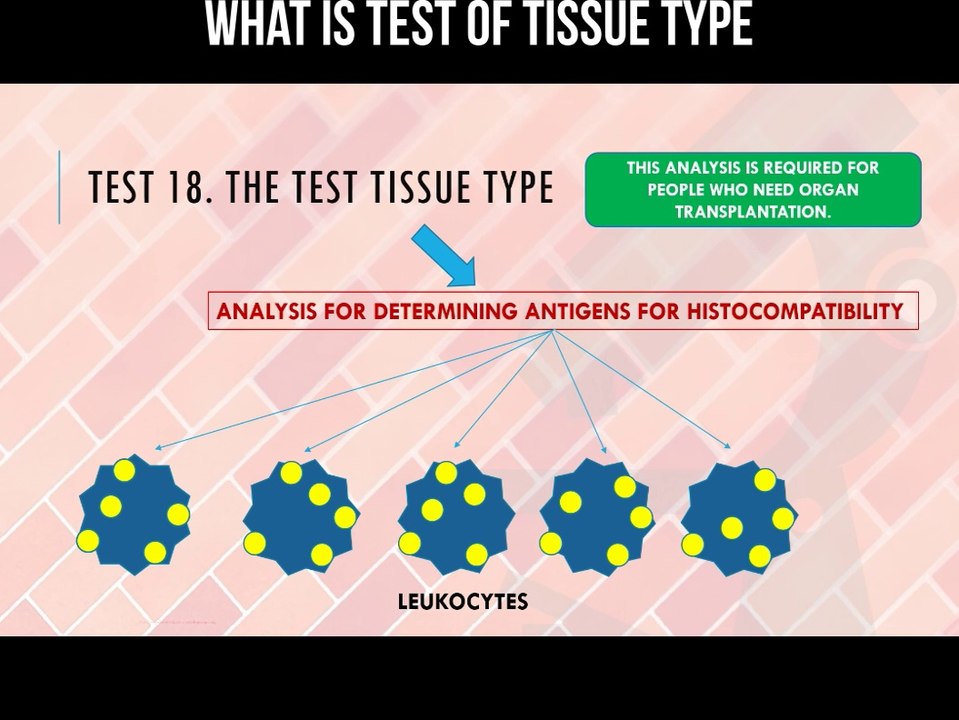 What is test of tissue type?