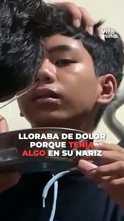 Sanguijuela en nariz