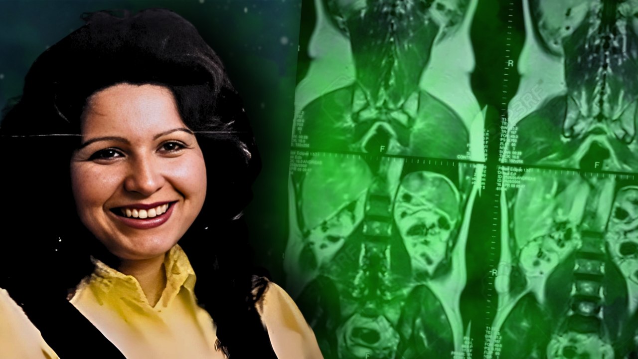 Gloria Ramirez : l'étrange affaire médicale non résolue