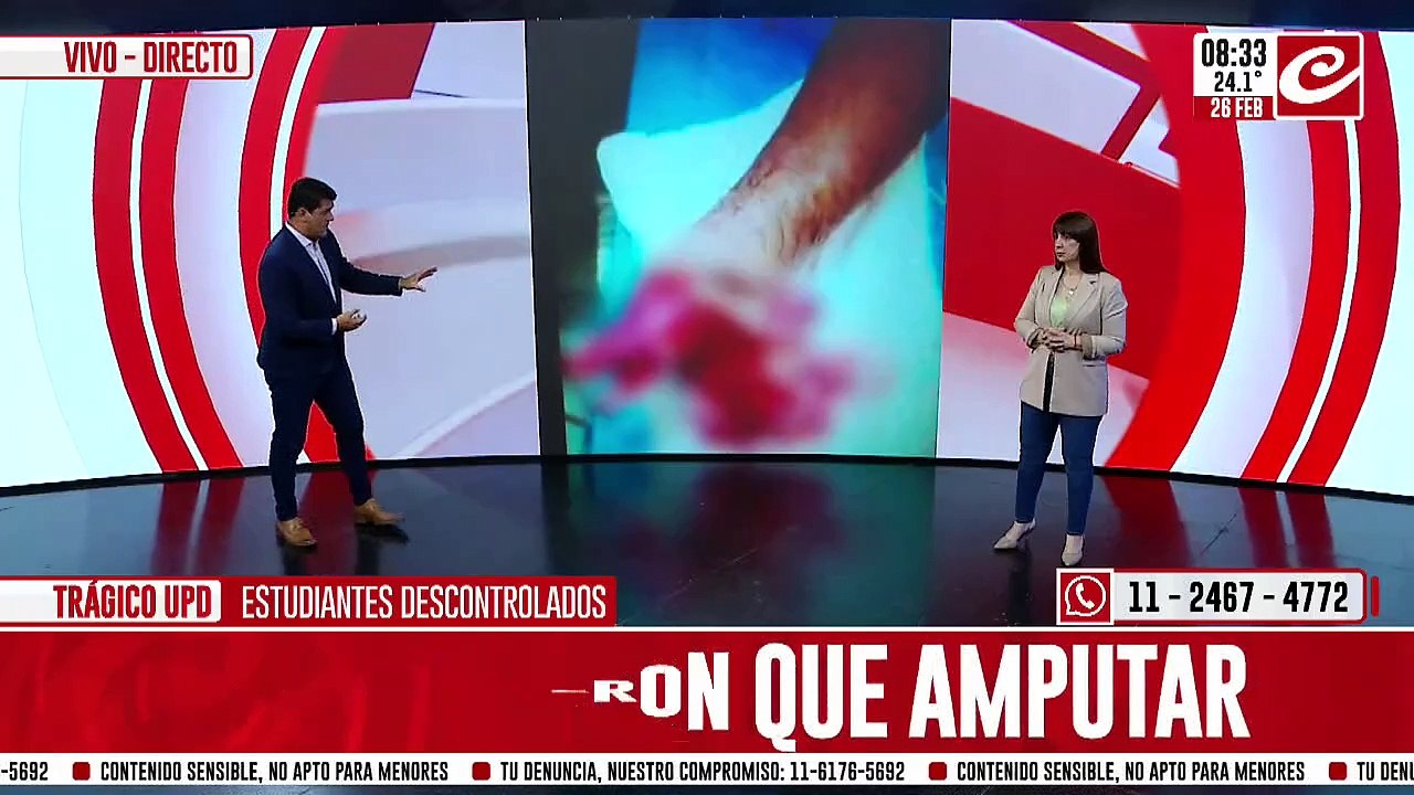 Tragedia en UPD: tuvieron que amputarle la mano a un estudinte