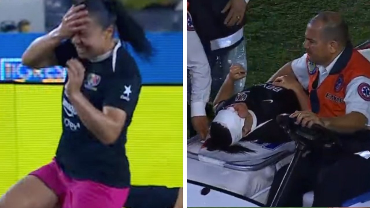 Charlyn Corral abandona el partido ensangrentada tras golpe Mapi León