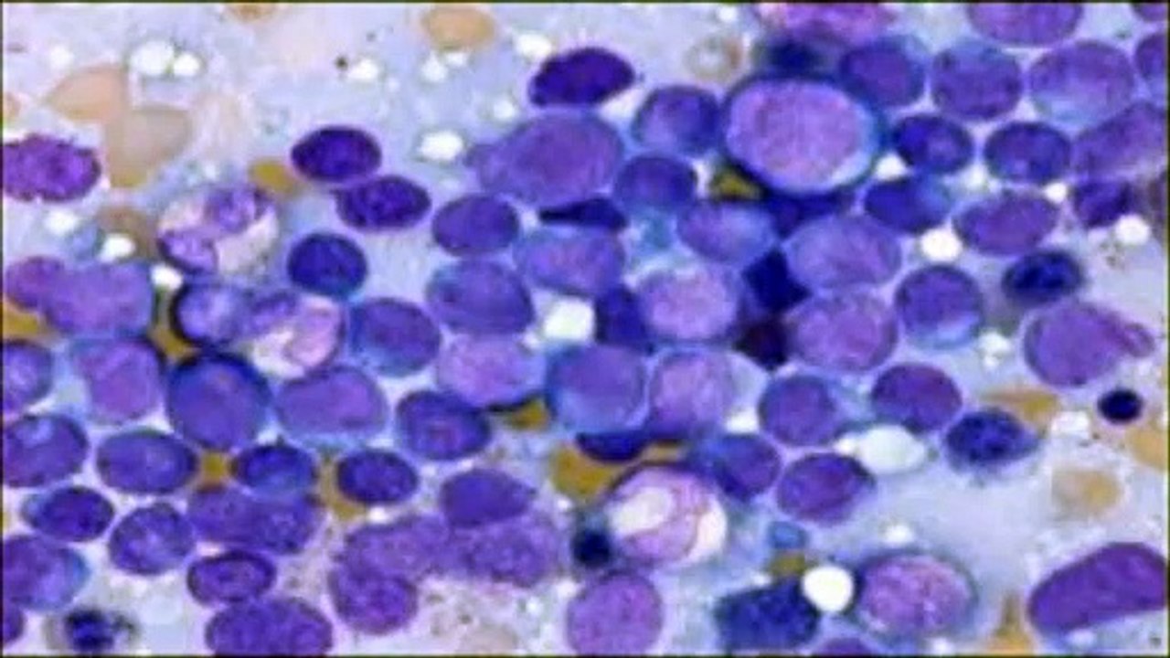 JONATHAN LORICK'S LIFE SAVING PLEA