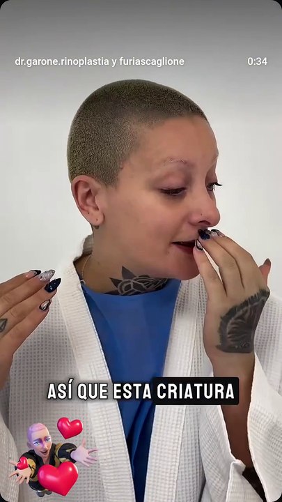 Furia se operó la nariz