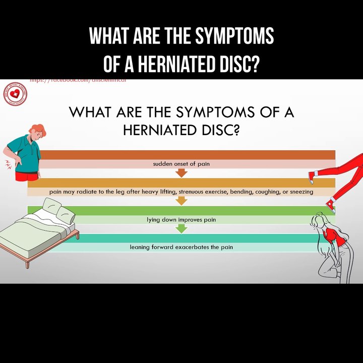 What are the symptoms of a herniated disc?