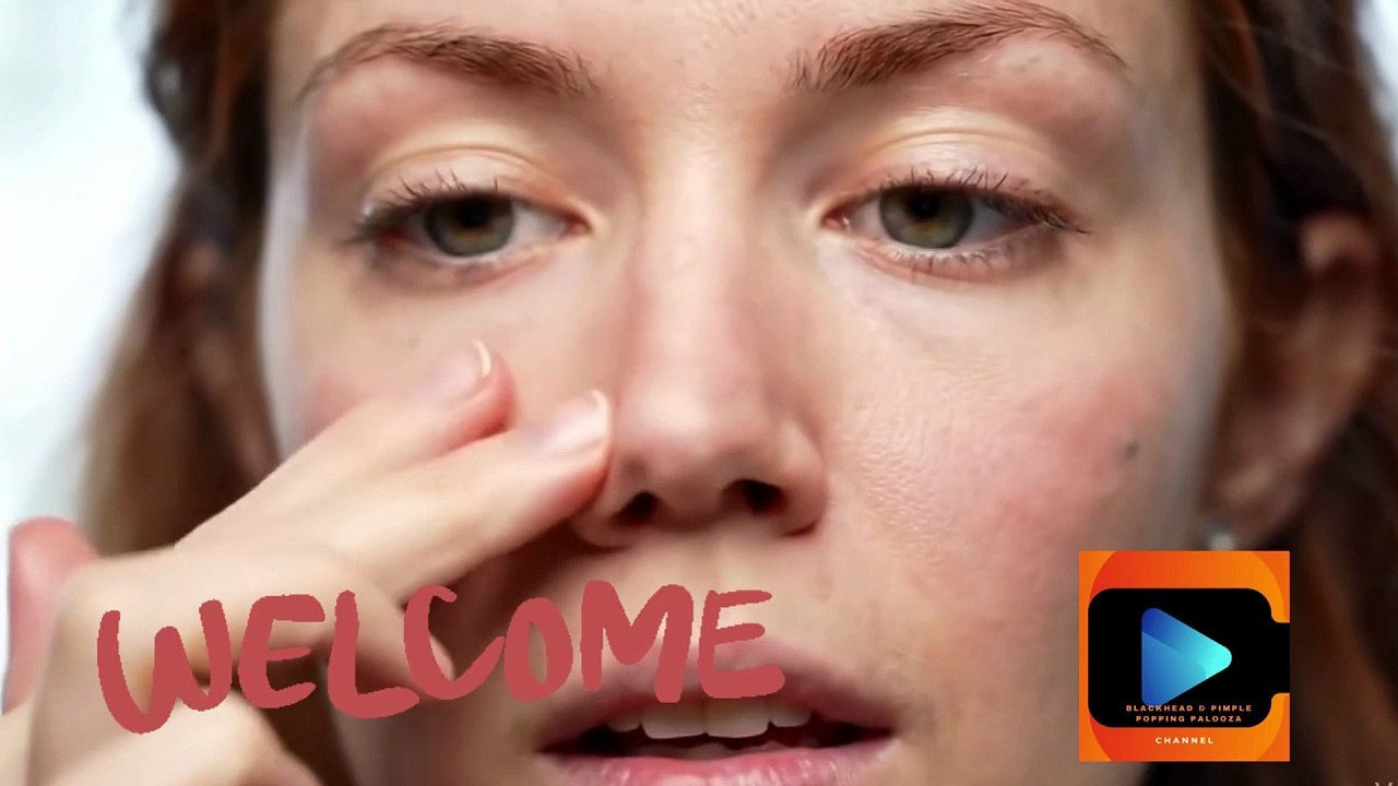 Satisfying Close-Up of Tiny Nose Blackheads Getting Gently Squeezed