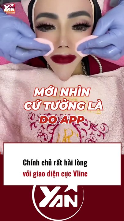 Cô gái sở hữu khuôn mặt Vline chuẩn theo nghĩa đen