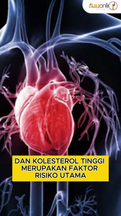 Deretan Manfaat Daun Salam untuk Kesehatan, Salah Satunya Cegah Pikun