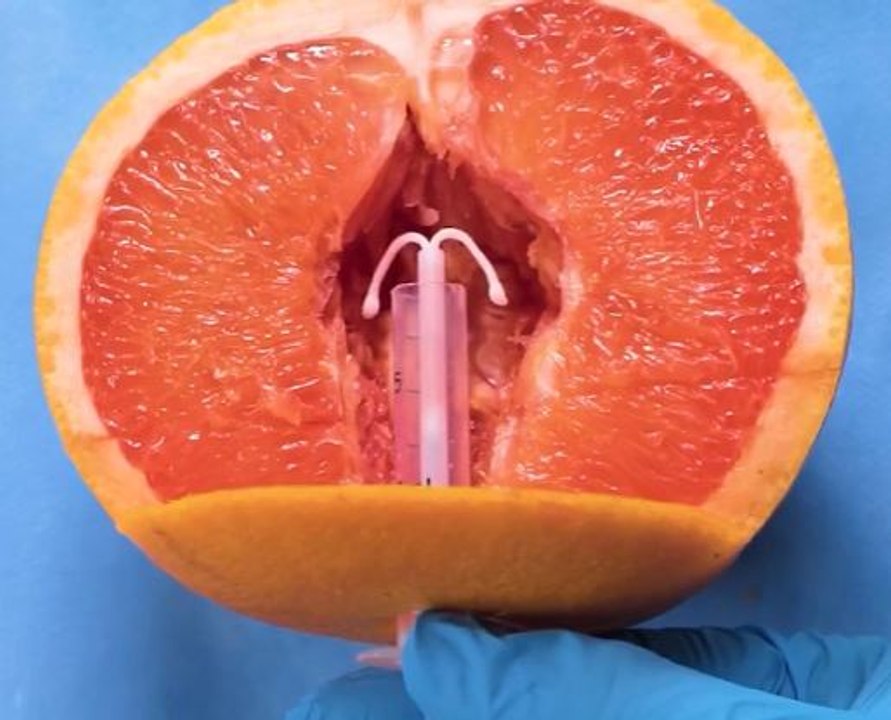 Medical Procedures Explained Simply