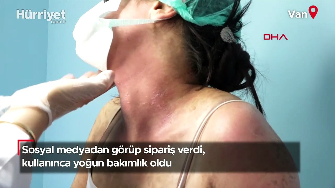 Sosyal medyadan görüp sipariş verdi, kullanınca yoğun bakımlık oldu