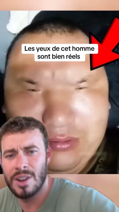 Sinon c’est chirurgie obligatoire