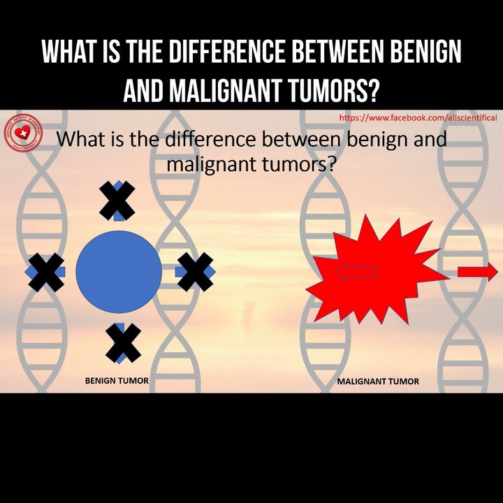 What is the difference between benign and malignant tumors?