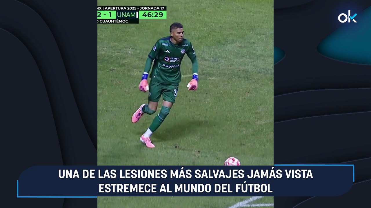 Una de las lesiones más salvajes jamás vista estremece al mundo del fútbol