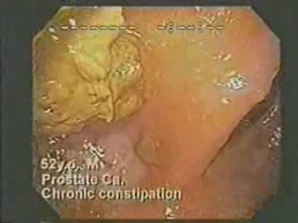 Why Celebrities use Alkaline water?