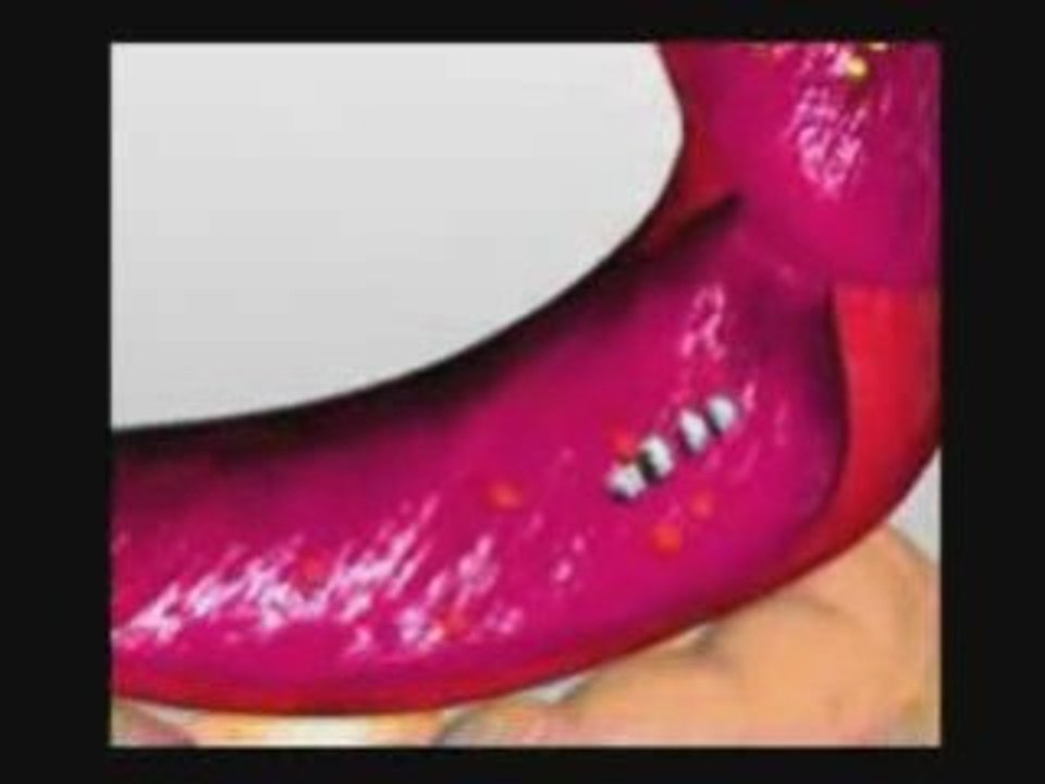 An Introduction to Proteolytic Enzymes and Digestive Enzymes