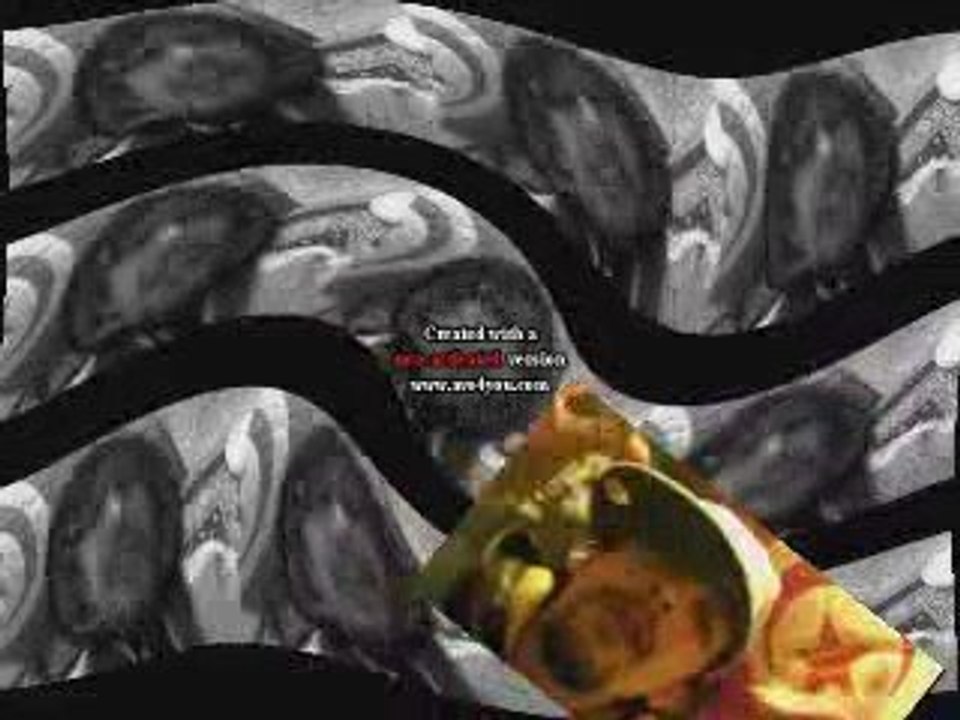 Tunis Rap & Hip Hop Scene 🎤