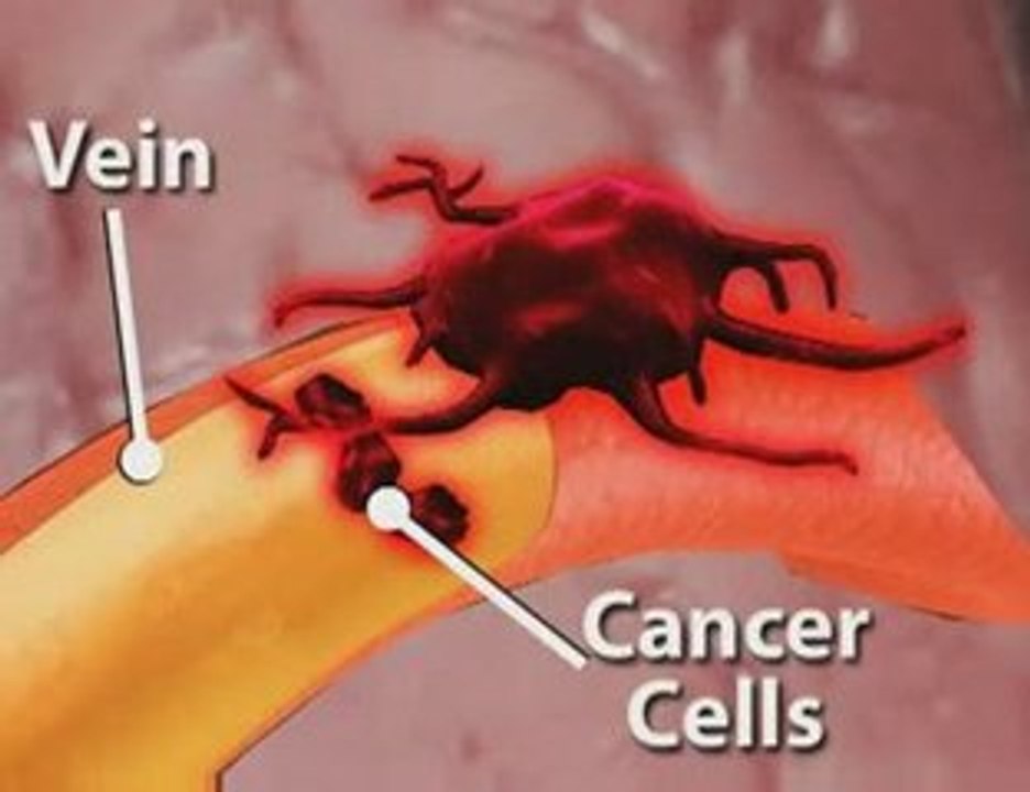 Understanding Cancer: Key Insights