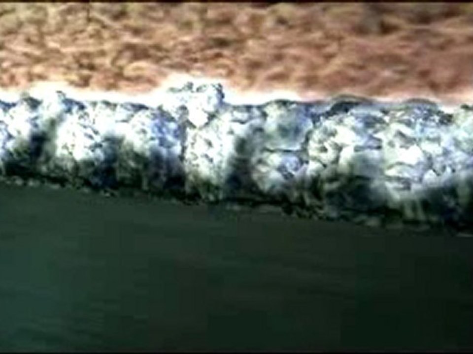 Biomedical Implant Coatings