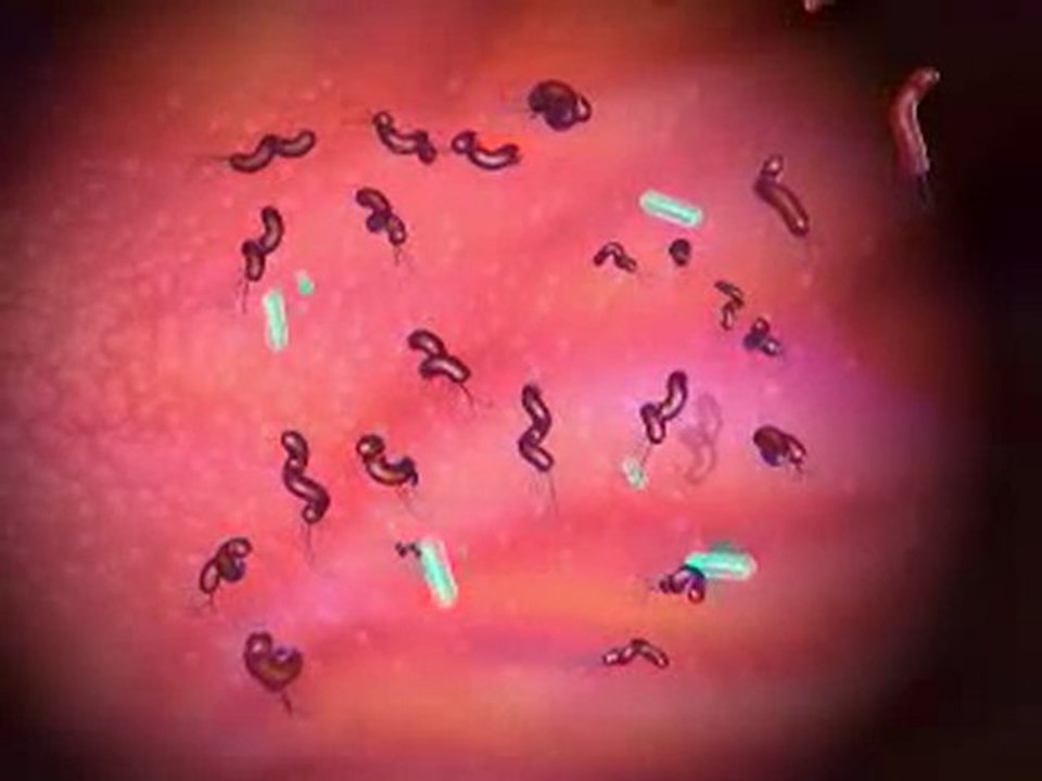 What are Probiotics?