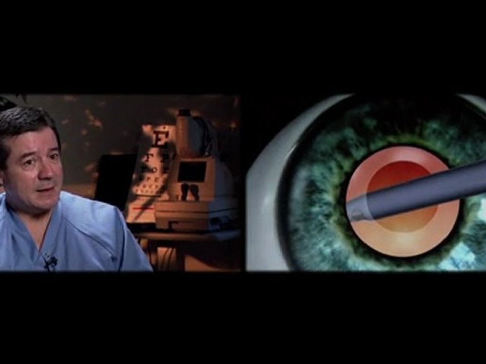 The Cataract Surgery Experience - Barnet Dulaney Perkins Eye