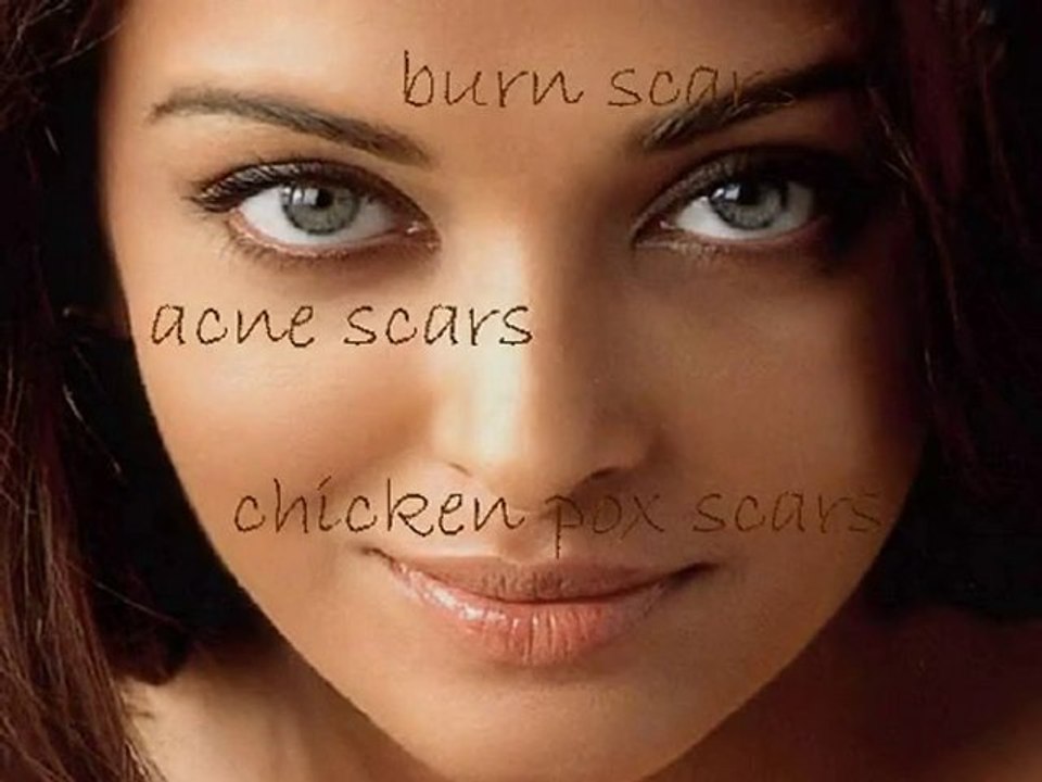 how to get rid of scars