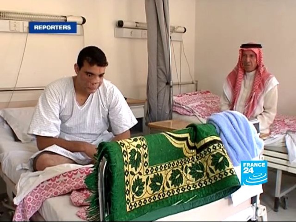 Iraq’s war wounded