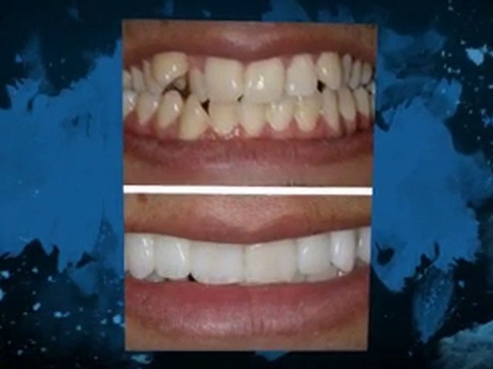 Choose the right Oxford Dentist at the right Oxford Dentist