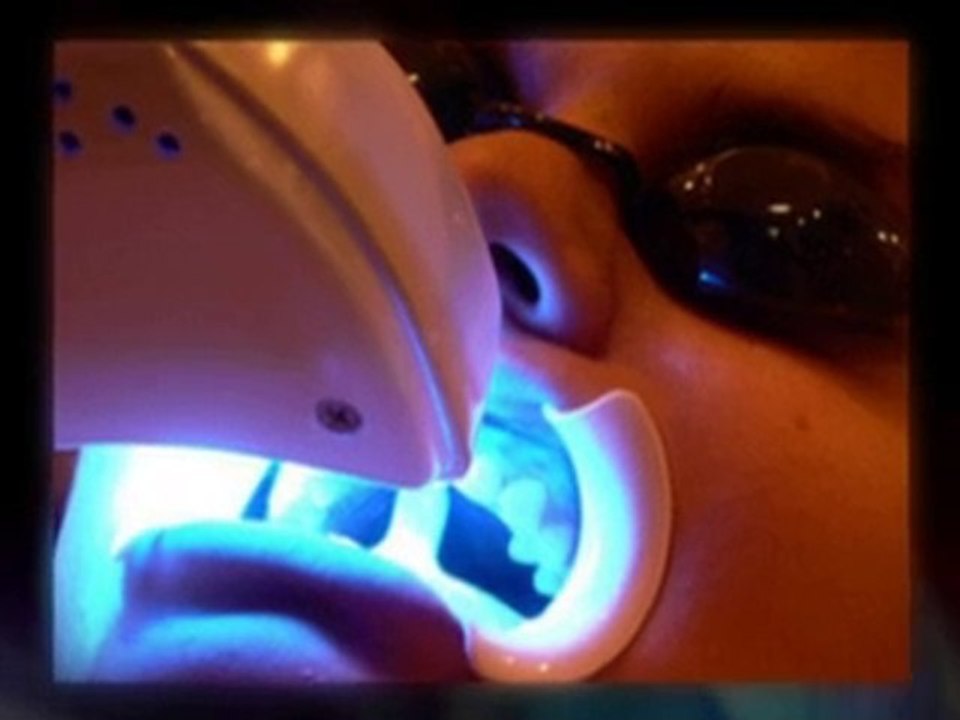 Oxford dentists at oxford dentistry describe orthodontic ca