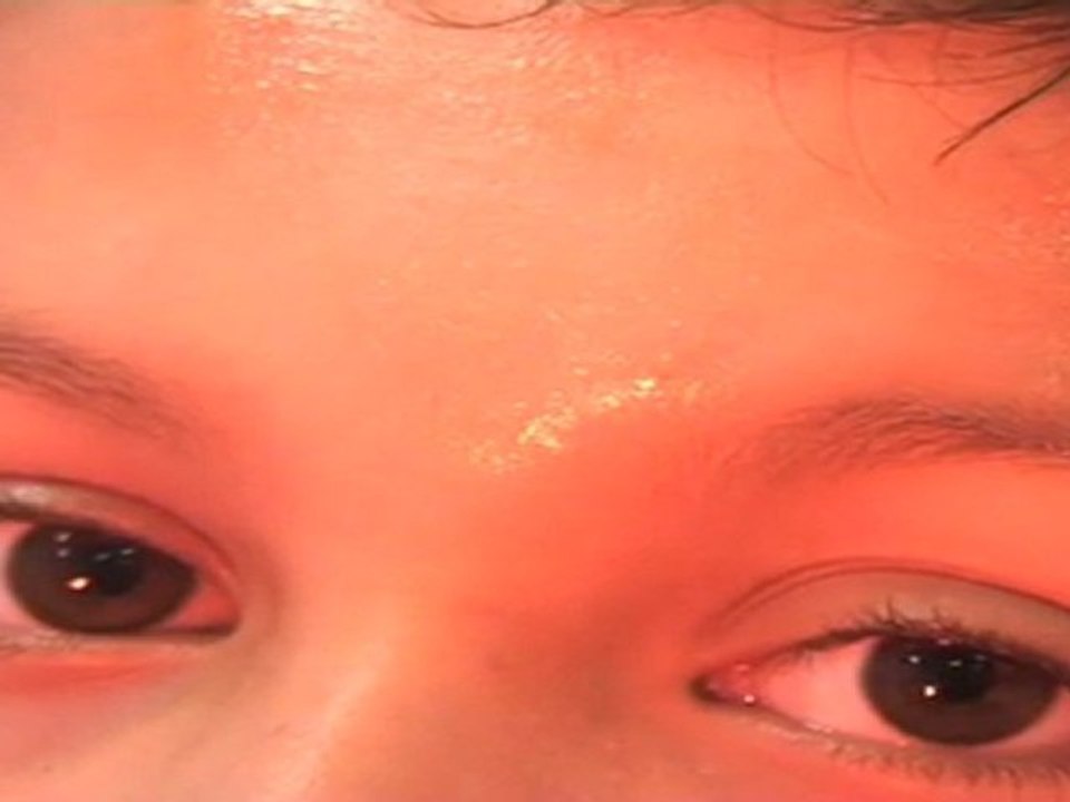 "Match Match Match" 00'31