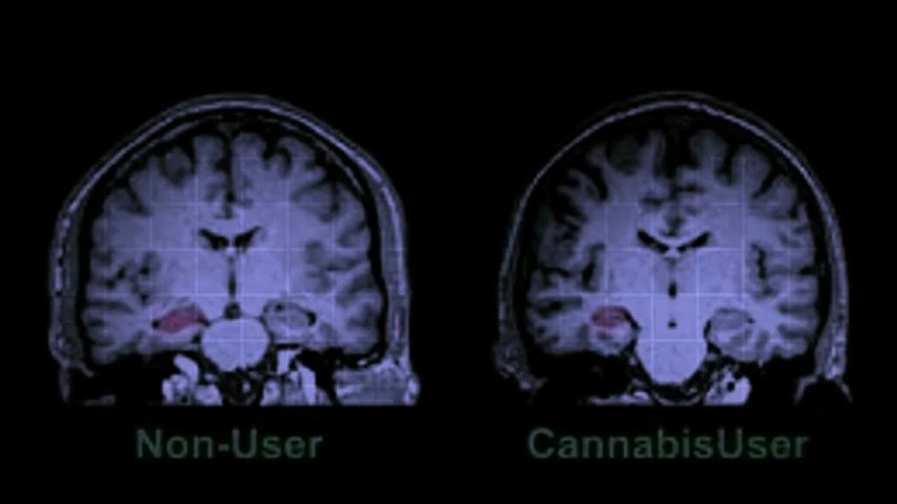 Expert Seed Bank - Health Effects of Cannabis Strains