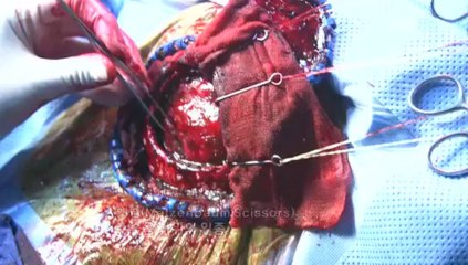 Cn.and.Al.20-001: Case Overview