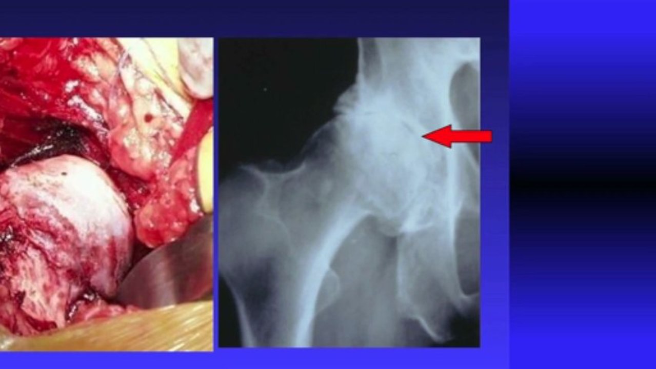 An Introduction to Arthritis.mov