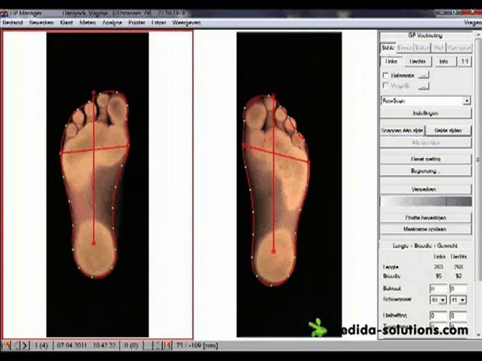 2D Voet Scanner & Custom Orthotics 🦶