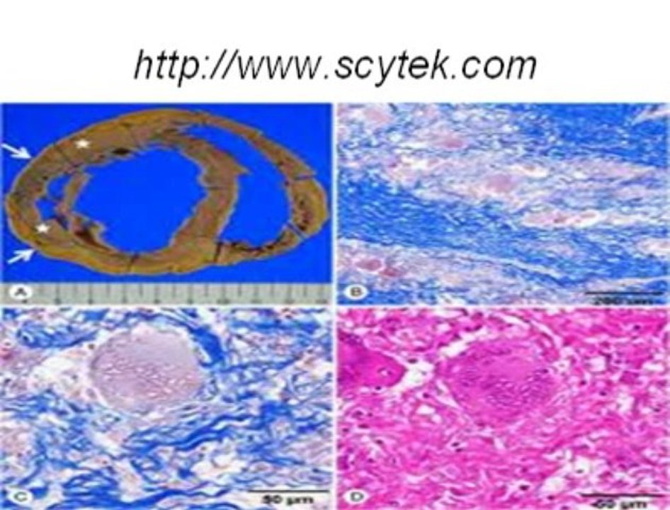 Scytek Laboratories- Special Stains, Antibodies, Hematology, Microbiology, Hematoxlyn,Dab,Chromogen,GRAM STAIN KIT, Methylene Blue Solution