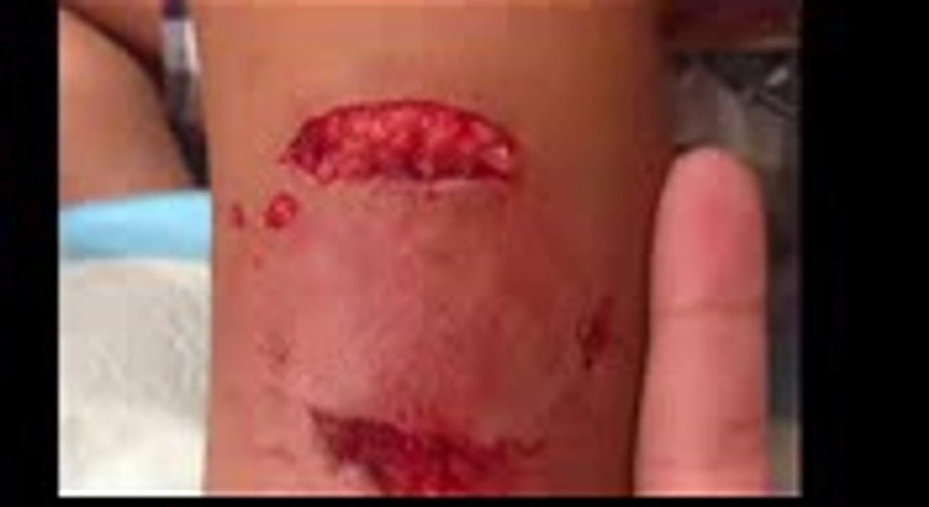 Cat Saves Boy from Attacking Dog 🐱